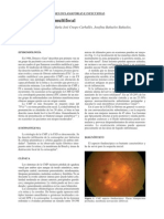 Cap 07-07 Coroiditis Multifocal