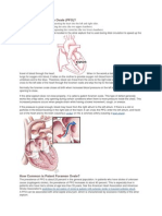 What Is Patent Foramen Ovale