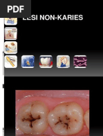 Download GM 24 - Erosi Abrasi Abfraksi Dan Atrisi by Suci Sylvana Hrp SN248453183 doc pdf