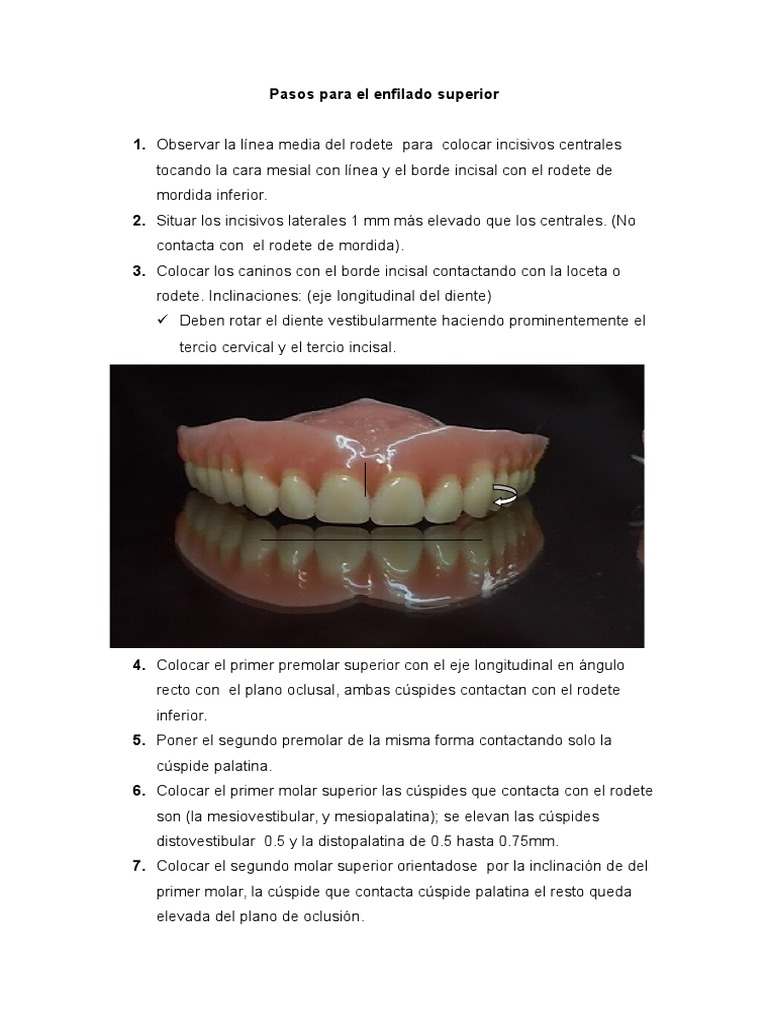 Pasos para El Enfilado Superior | PDF