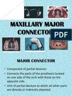 Maxillary Major Connectors
