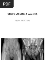 Download Fraktur Pelvis by Hasrudin Al-Munajat SN248748869 doc pdf
