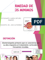 Enfermedad de Cambios Minimos