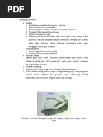 Rebasing Gigi Tiruan Akrilik