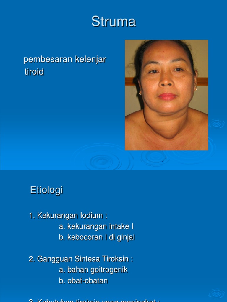 Struma | PDF