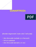 Gonartroza