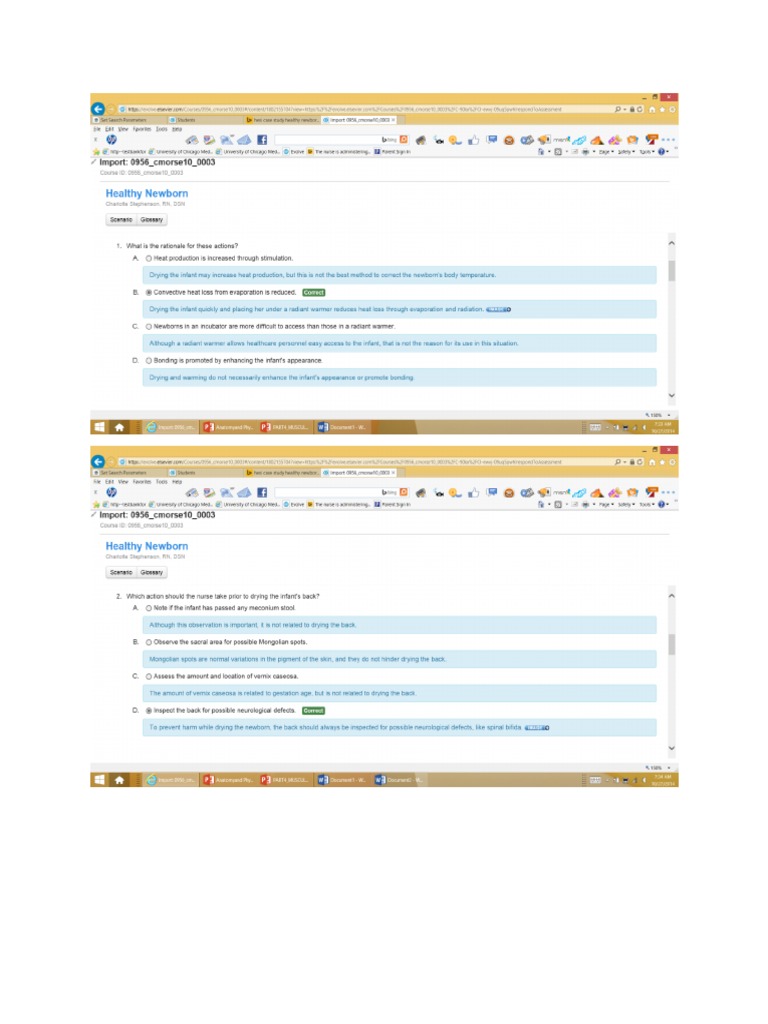 Which findings are consistent with an infant born at 38 weeks' gestation picture