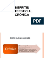Nefritis Tubulo Intersticial Cronica