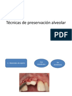 Técnicas de Preservación Alveolar