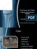 Fractura Tibia