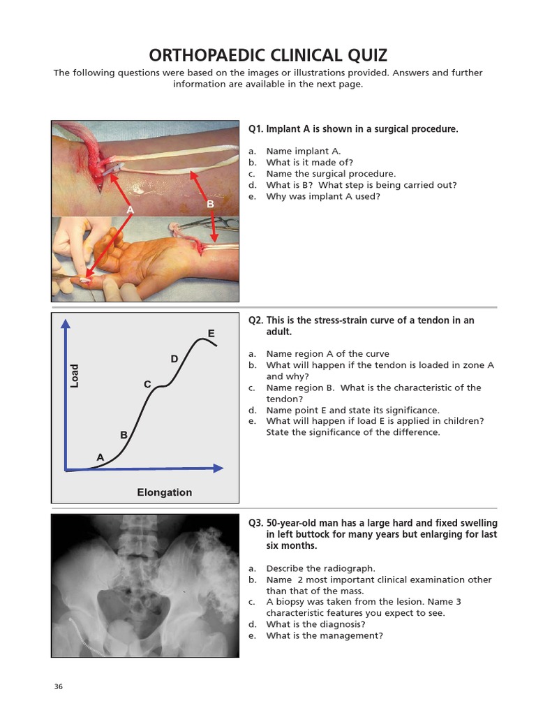 Orthopaedic Clinical Quiz Tendon Pathology