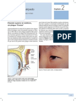 Parpado Asiatico PDF