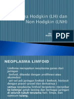 Limfoma Hodgkin