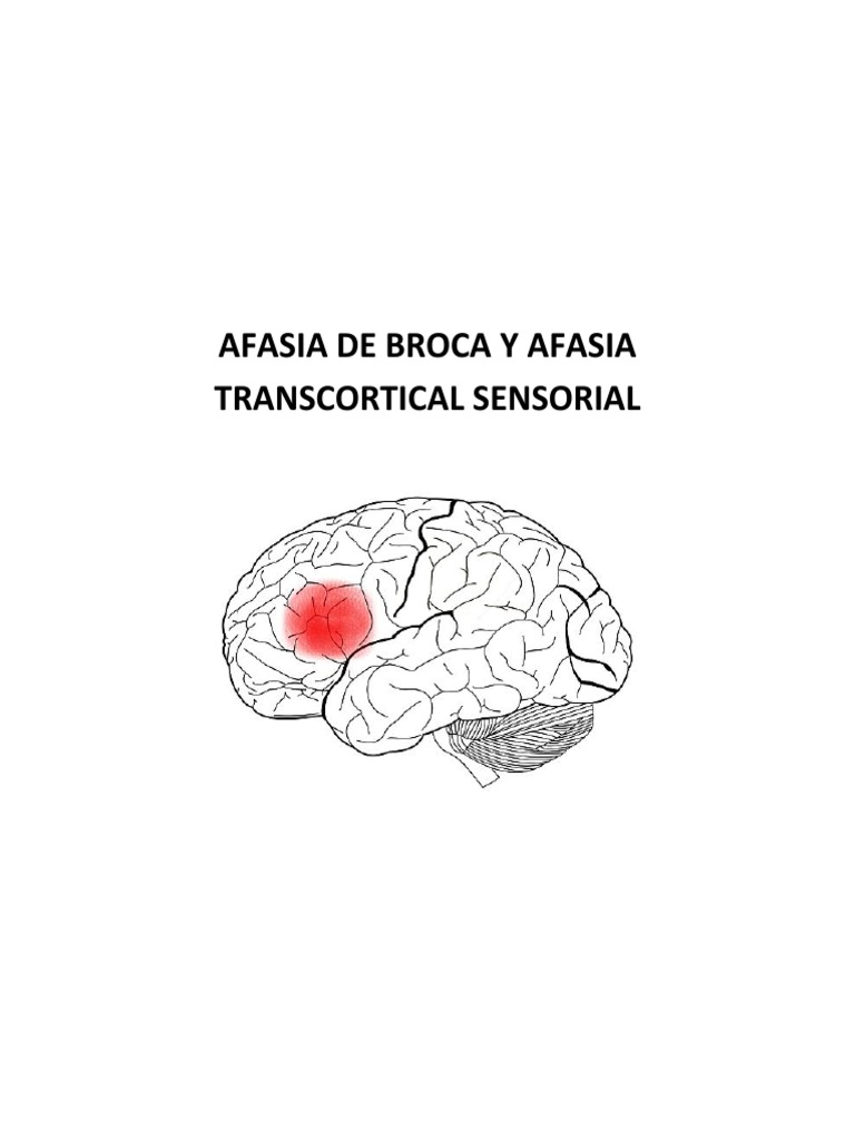Afasia de Broca y Afasia Transcortical Sensorial Afasia Neurología