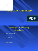 Maxillary Anesthesia -2