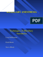 Maxillary Anesthesia - 2