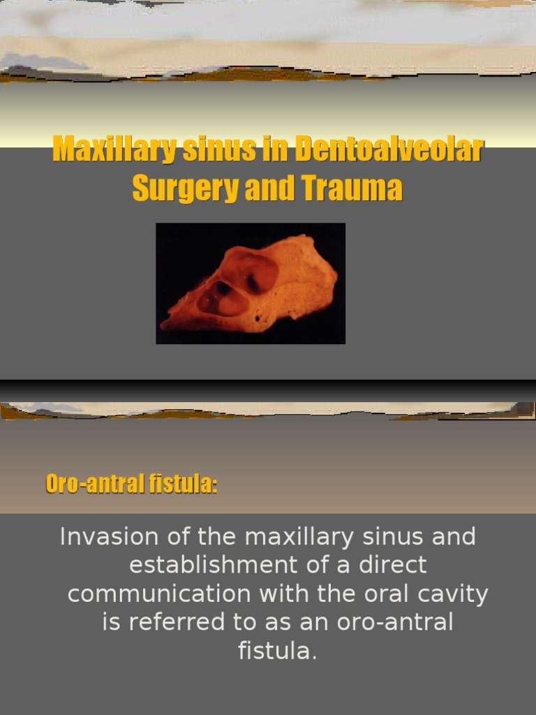 MaxSinus Lecture 2 | PDF | Mouth | Clinical Medicine