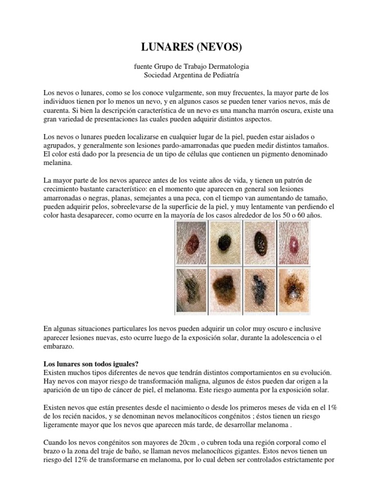 116 Nevus Melanoma Fotos de stock - Fotos libres de regalías de Dreamstime, image size:768x1024