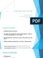 Cancer de Vulva