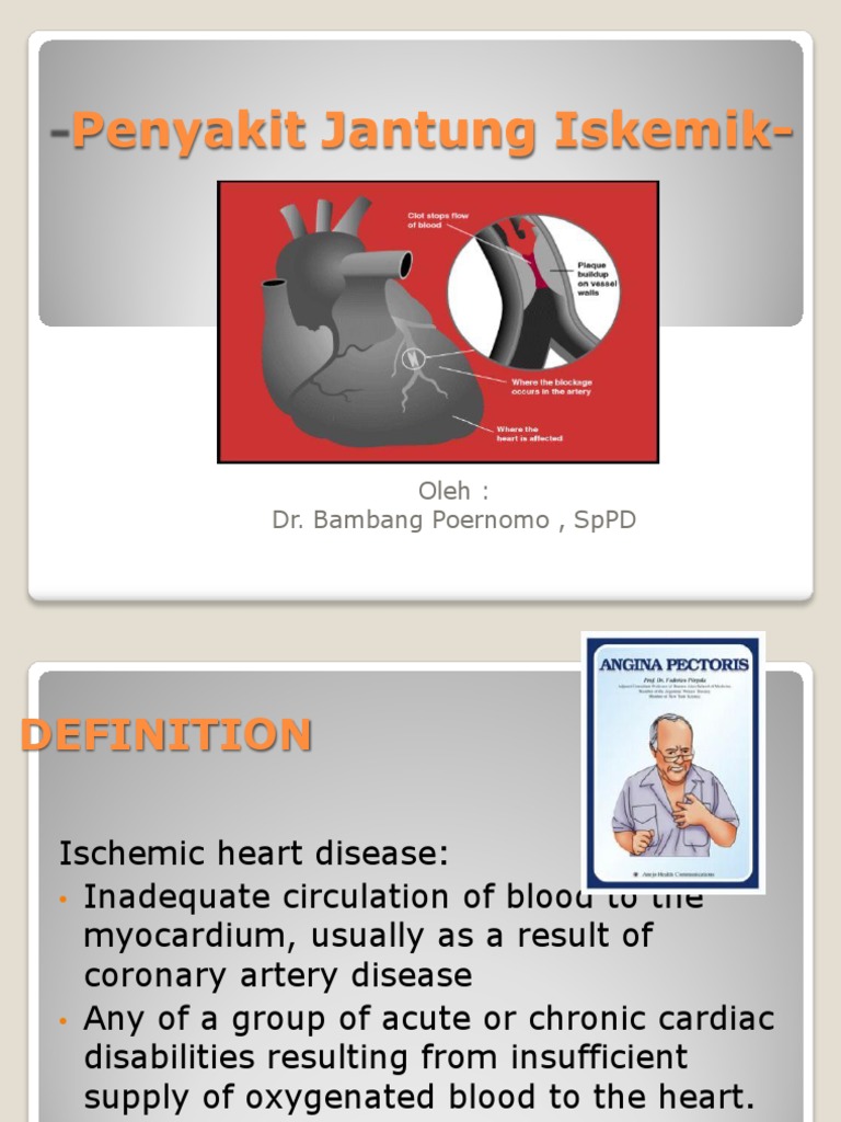 penyakit-stroke-ppt-download-blogmangwahyu