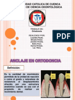 Anclaje en Ortodoncia: Definición, Clasificación, Tipos y Zonas Anatómicas