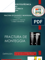 Fractura de Monteggia y Gallazzi