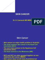 Skin Cancer: Dr. D. Czarnecki MD MBBS