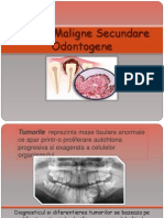 Tumori Secundare Metastaze