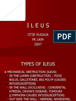 ILEUS