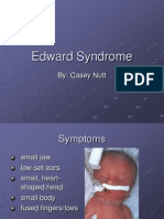 Edward Syndrome