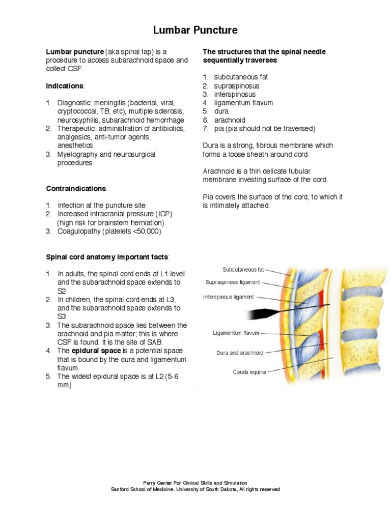 Lumbar Puncture Central Nervous System Diseases And Disorders