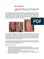 Obat Cacar Air Di Penis PDF