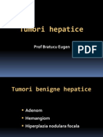 Tumori Hepatice