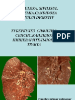 14 Stom - Tuberculoza Sifilisul Septicemia