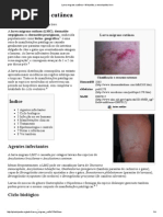Larva Migrans Cutânea – Wikipédia, A Enciclopédia Livre