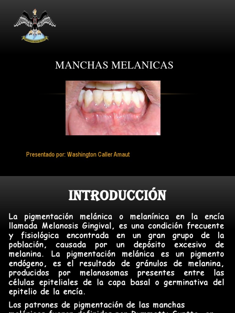 manchas melanoticas maculas labios Las mculas melanticas son que presentan un aumento de pigmentacin debido a Manchas en la piel: por