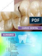 Caries Dental