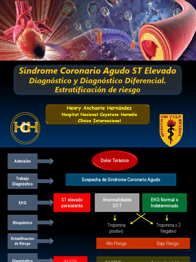 Diagnóstico del SICA ST Elevado | PDF | Electrocardiografia | Infarto ...