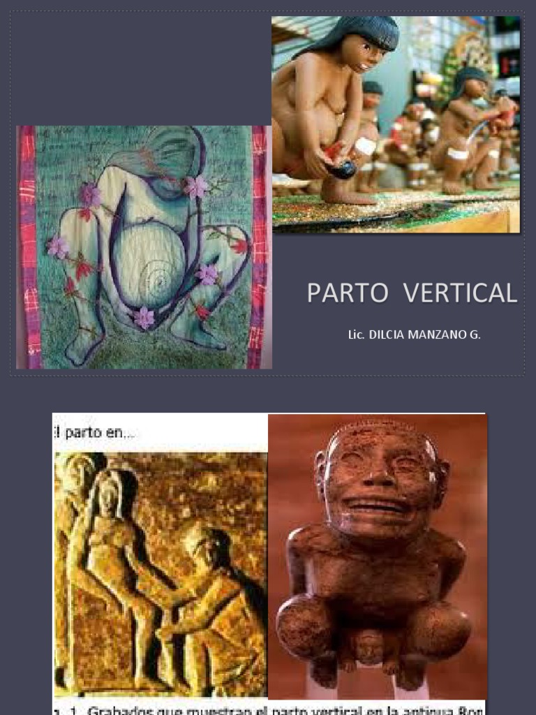 Beneficios del Parto Vertical | PDF