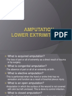 Amputation