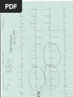 Ecg Com Defeito