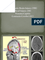 Traumatic Brain Injury (TBI)
