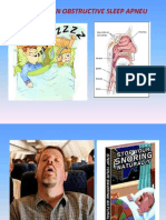 Snoring Dan Obstructive Sleep Apneu