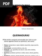 QUEIMADURAS