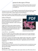 TB Tests - Skin Test, Sputum & Other Types of TB Test