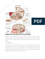 Epidural Hematom