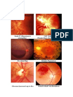 Labelled Fundus Pictures (1)