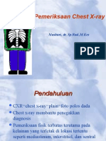 Chest X-ray-mashuri 2014.ppt