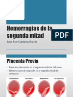 Hemorragias de La Segunda Mitad Del Embarazo