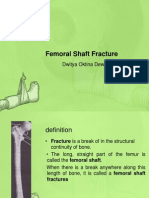 Fracture Shaft Femur